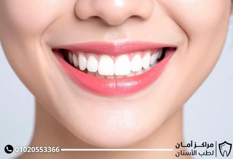مدة تقويم الاسنان البارزة: الدليل الشامل للعلاج والنتائج
