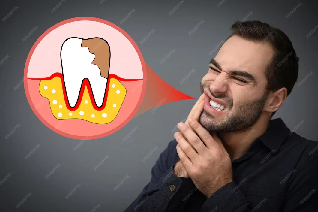 تعليمات ما بعد زراعة الاسنان