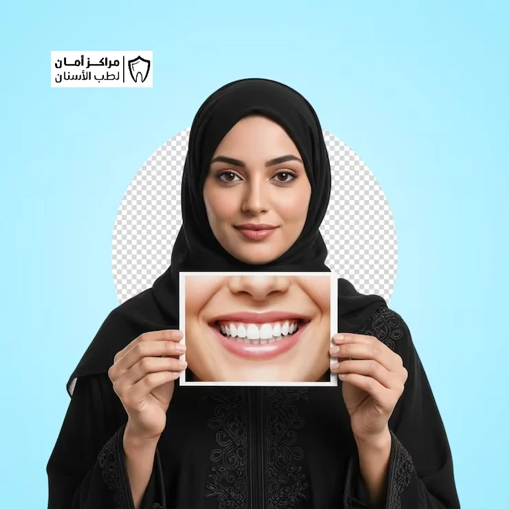 هل نتائج تجميل الاسنان دائمة