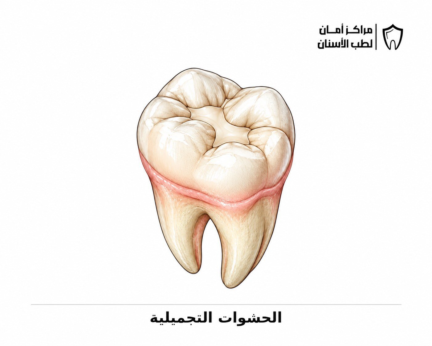 الحشوات التجميلية